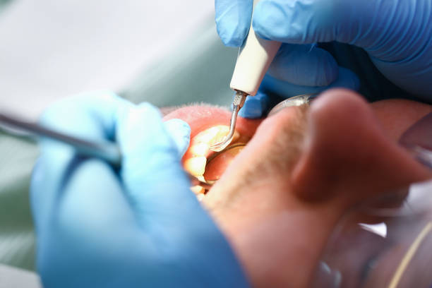 Best Emergency Treatment for Jaw Pain or Injury in Spooner, WI